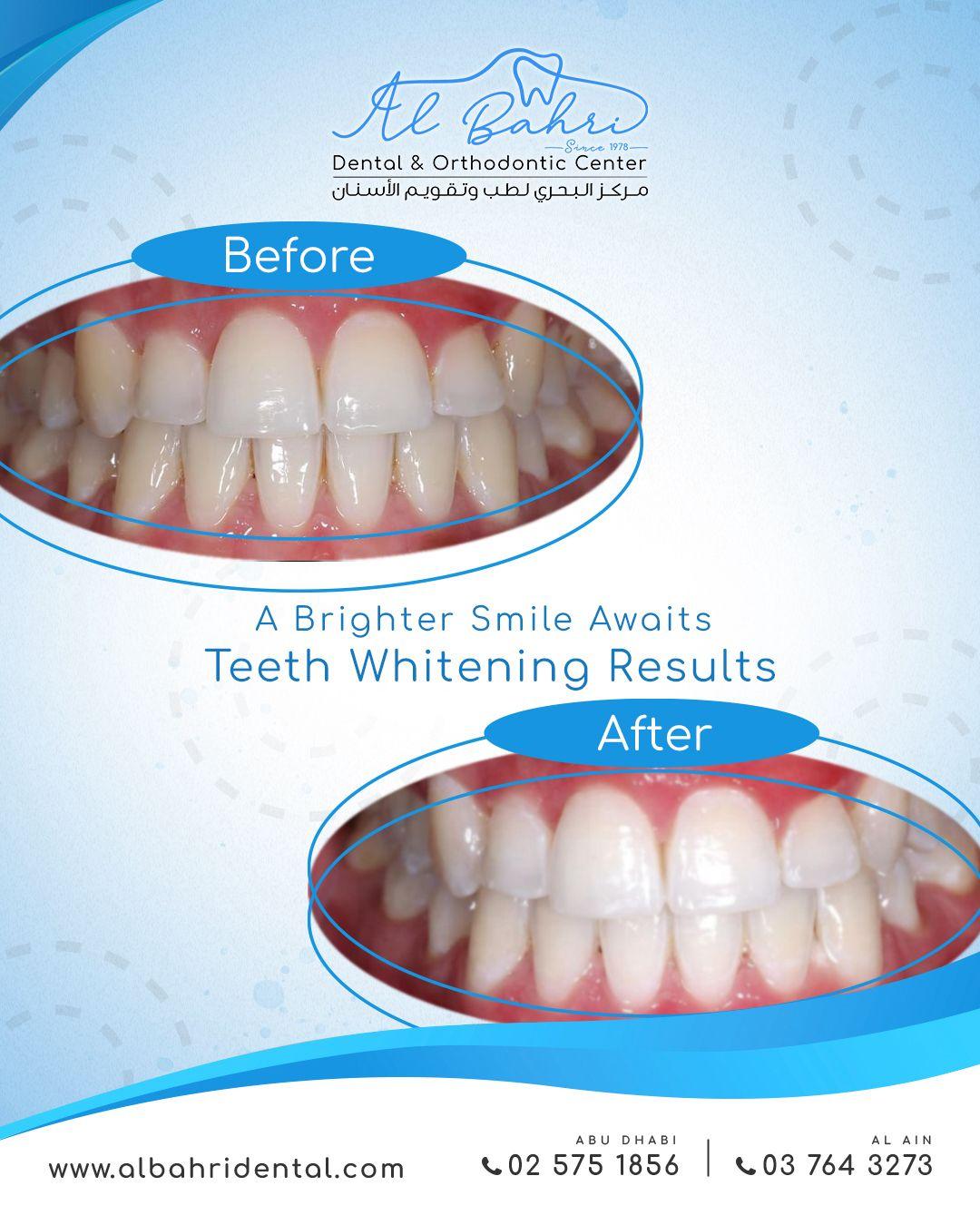 Al Bahri Dental & Orthodontic Center L.L.C. — photo 3